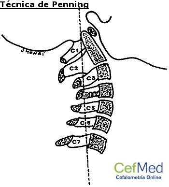 Técnica de Penning