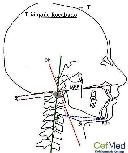 triangulo-rocabado