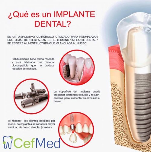 ortodoncia implantes dentales