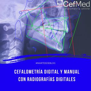 programa con estudio de cefalometrías